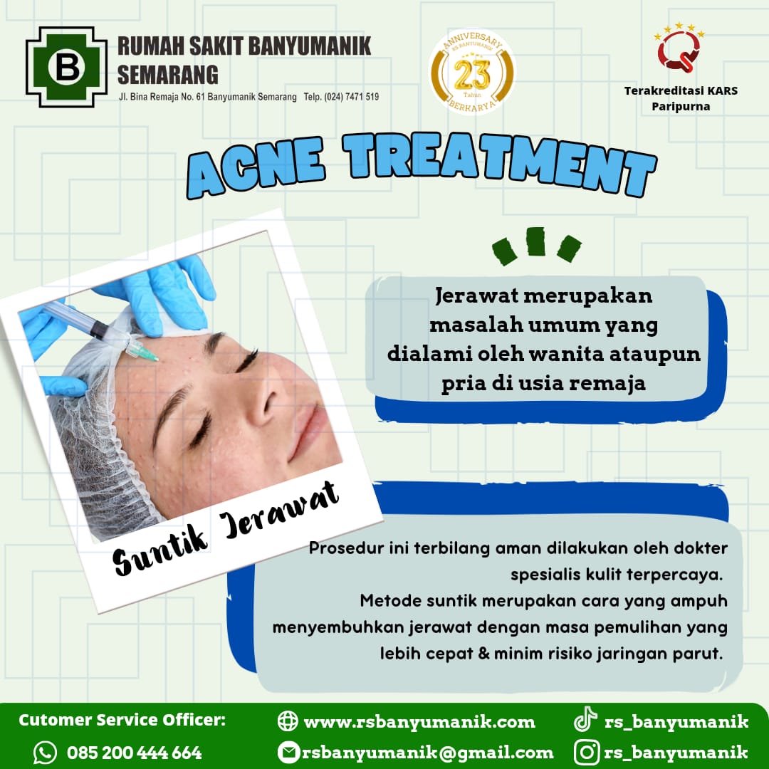 Acne treatment RS Banyumanik
